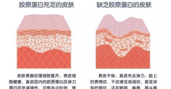 含有胶原蛋白的食物有哪些，什么食物能补充胶原蛋白肽图1