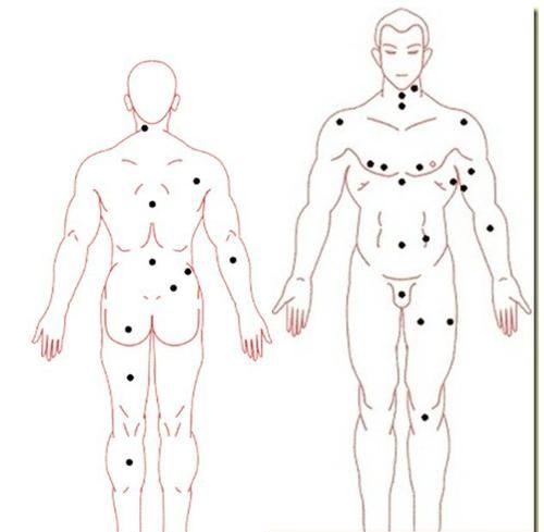 全身痣相图解男人左右,面部痣相图解男人左右脸图4