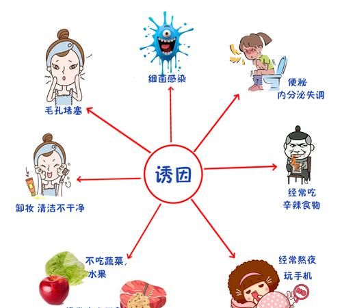 什么是痤疮 痤疮的含义,什么是痤疮图3