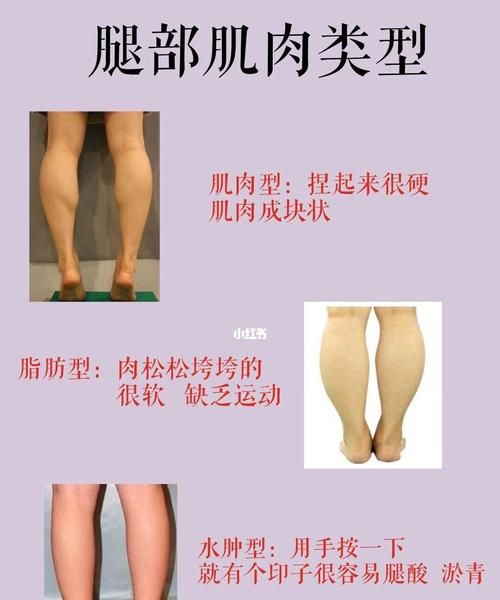 萝卜腿怎么变细变直,萝卜腿怎么变细变直学会这几招图1