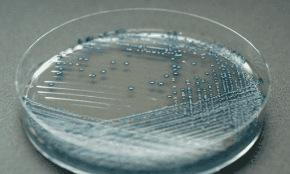 常见的培养基有哪些类型,培养基的种类有哪些高中生物图2