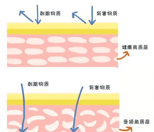 角质层薄可以用导入仪,如何增厚皮肤角质层图11