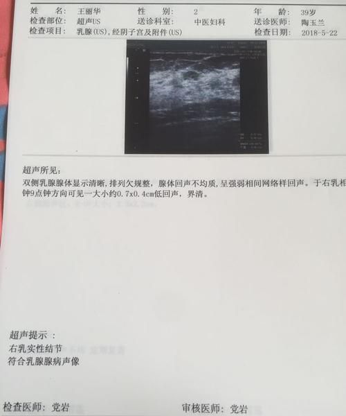 乳腺结节乳钙化怎么办,检查乳腺增生需要空腹图1