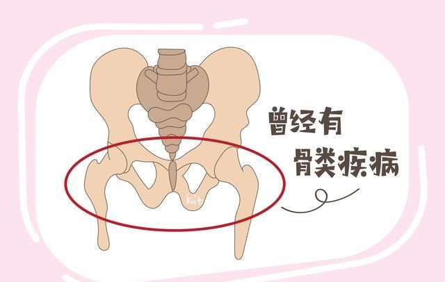 耻骨在哪里 耻骨位置是哪里,耻骨在哪里 位置图图4