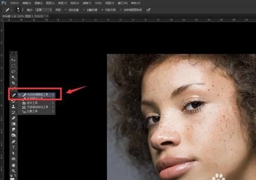 ps怎么去斑点,ps怎样去除脸部的痣或其他斑点图2