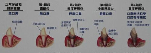 牙齿的成分是碳酸钙,碳酸钙是构成骨骼牙齿的主要成分图3