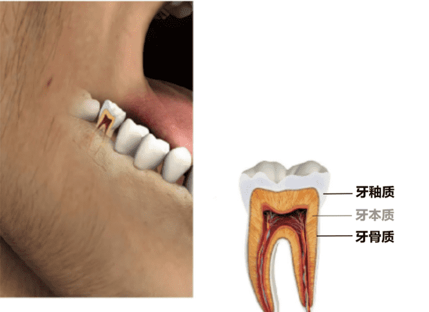 牙齿的化学成分是什么,人体骨骼哪一种化学成分最多图2