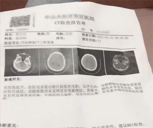 上班时间脑梗如何赔偿,在工地发生脑梗可以算工伤图4