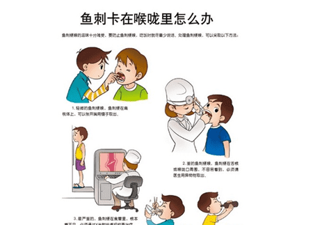 卡在喉咙里的鱼刺怎么去除,鱼刺卡喉咙的最佳处理方法图6