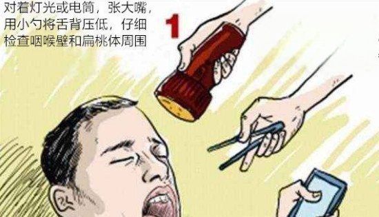 喉咙有细鱼刺怎么去除,喉咙扎了鱼刺怎么办图6