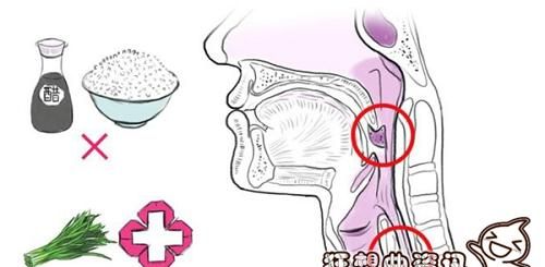 喉咙有细鱼刺怎么去除,喉咙扎了鱼刺怎么办图11